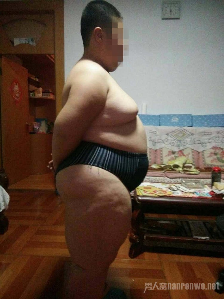 10岁小男孩体重182斤 坐着也能睡三年 单亲妈妈好烦恼