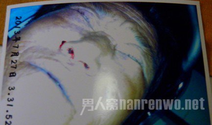 死者鼻孔中残有血迹 死者鼻孔中残有血迹