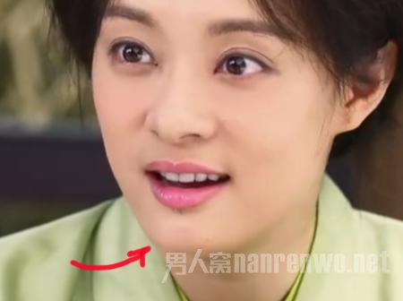 孙俪唇痣来历揭秘：因车祸形成 自嘲是女汉子:孙俪唇下的是什么