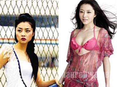 疑似熊黛林整容前后对比照