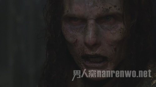 吸血鬼病发病原因