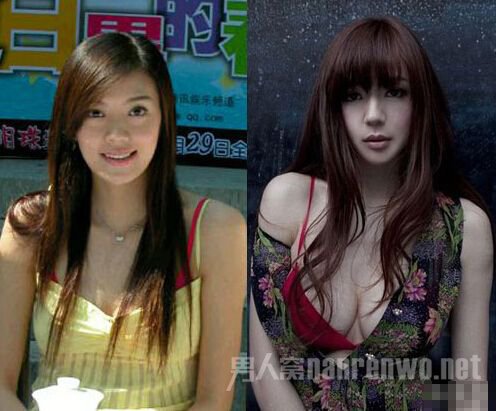 周韦彤整容了吗