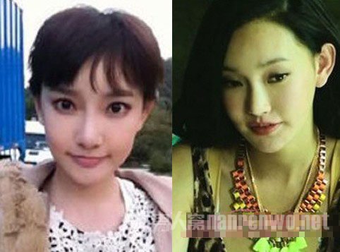 童菲整容前后