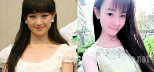 张檬整容前长相普通，整容后女神范十足