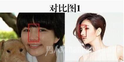 Ella整容前后对比照