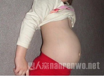 15岁少女腹中藏婴儿