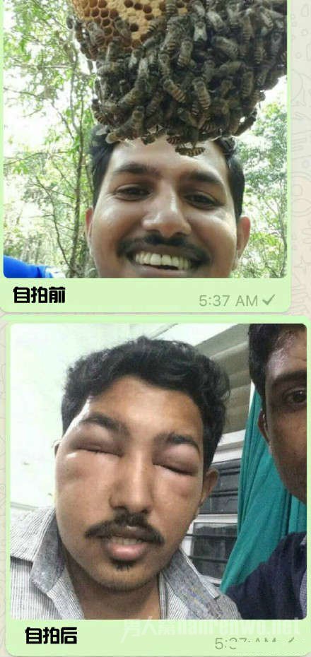 Ҽ޴ģ