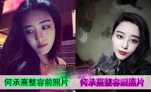 何承熹整容前后对比照长这样