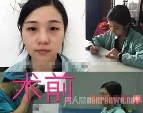 何承熹整容前照片