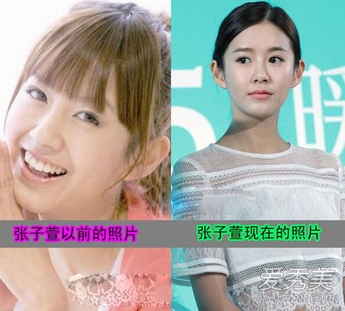 张子萱巴掌脸