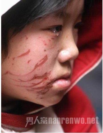 8岁女童被亲妈打谎称继母打的