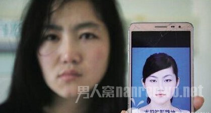 女子整容失明