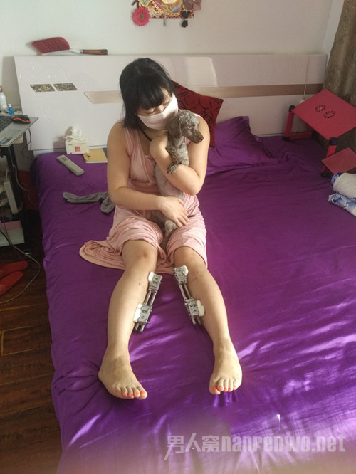 中国整形第一人