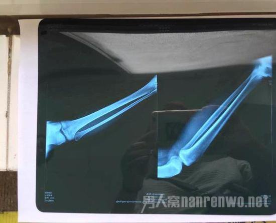 女商贩拍片结果