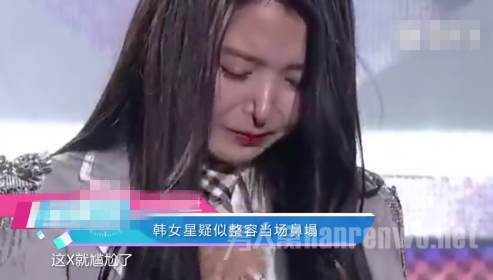鼻翼塌陷