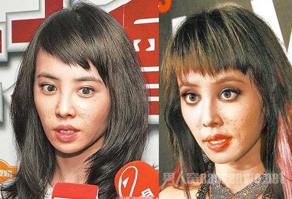 蔡依林严重冒痘