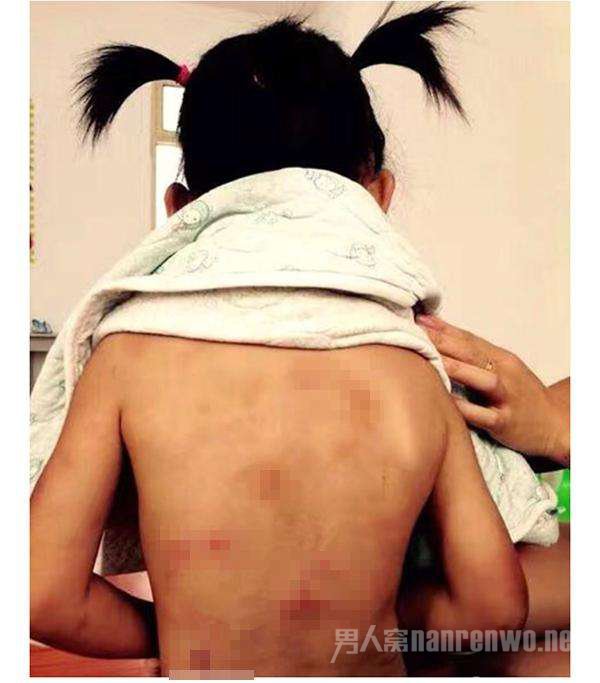虐待