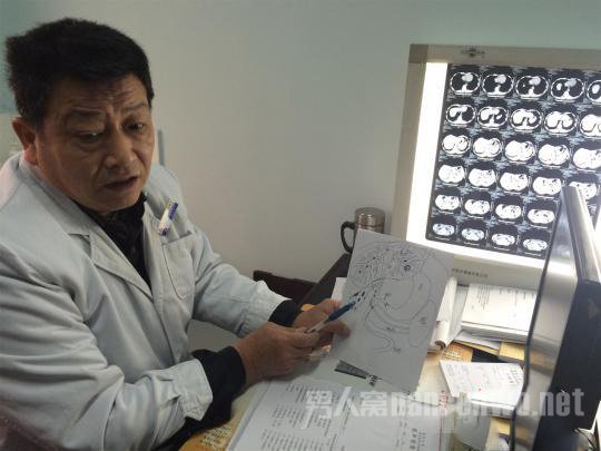 聂继光通过绘图方式向患者讲解病情