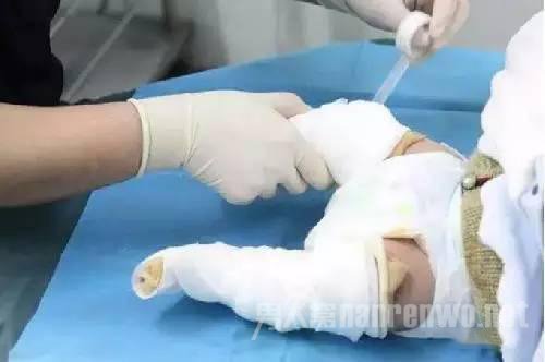 新生儿