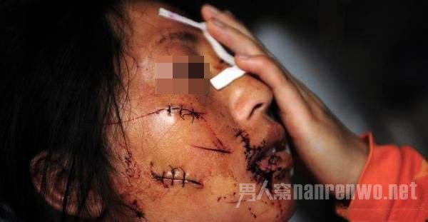 家庭暴力