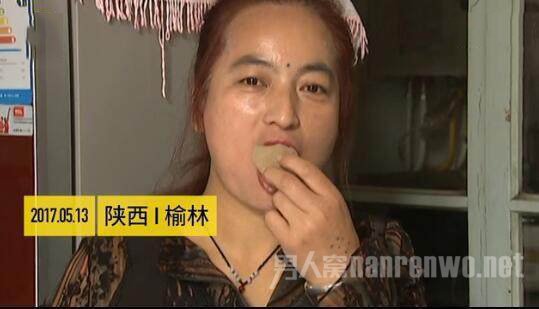 异食癖