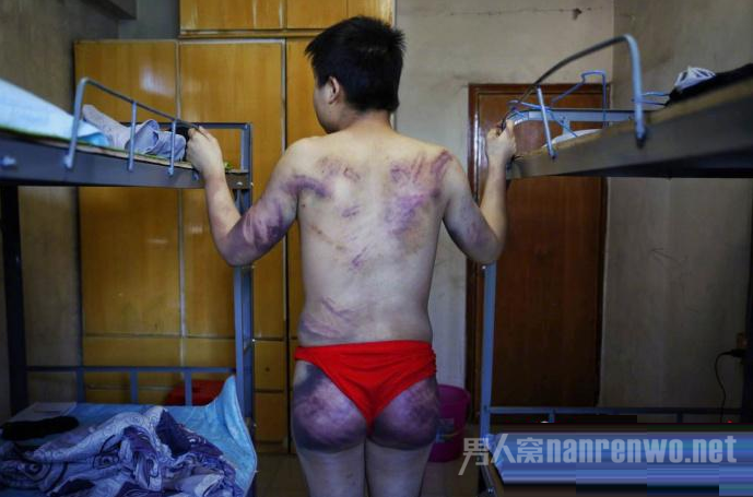 男子于仙人跳被殴打