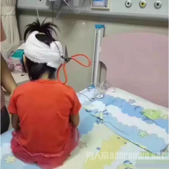 剪刀插入女孩头颅