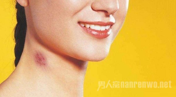 如何留下吻痕