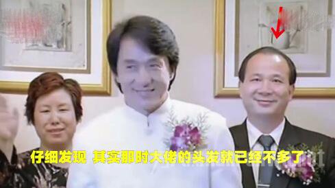 霸王老板也脱发