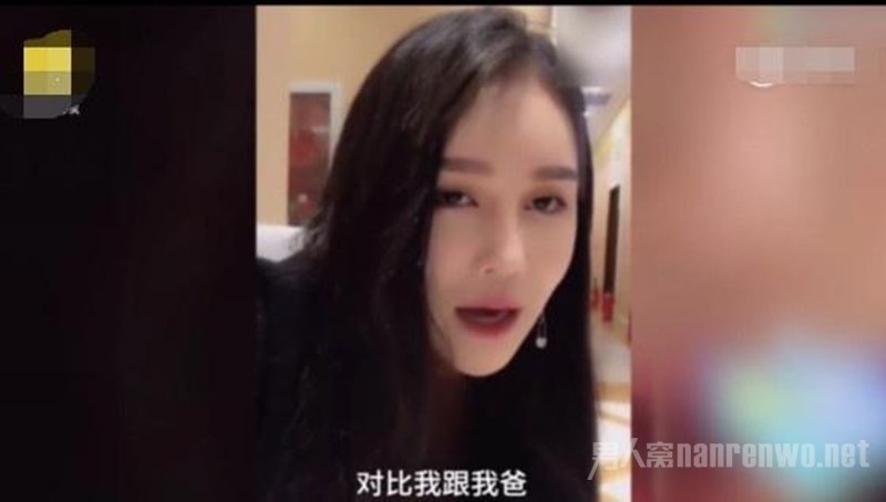 赵本山女儿承认整容