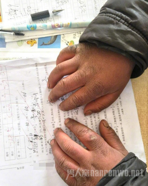 冰霜男孩