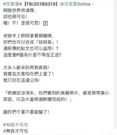 Selina在微博上发文晒照怒斥商家无良