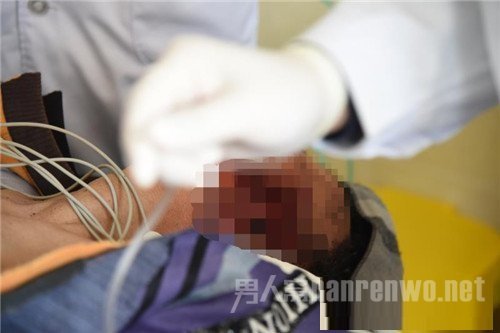男子被啃食后的脸