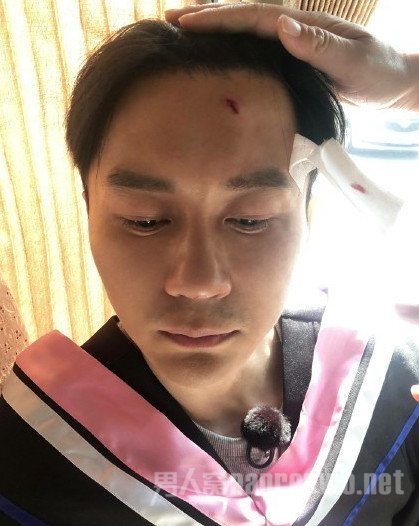 李晨录制节目受伤