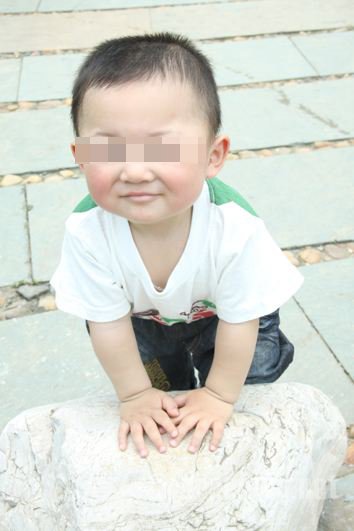 5岁男童因大小便不能控制