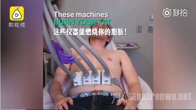 镭射溶脂体验