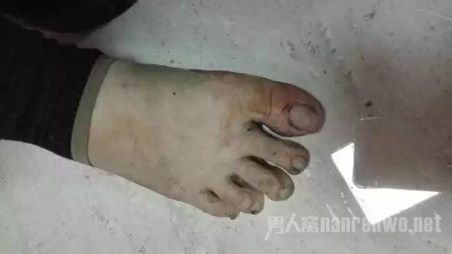 群殴受伤