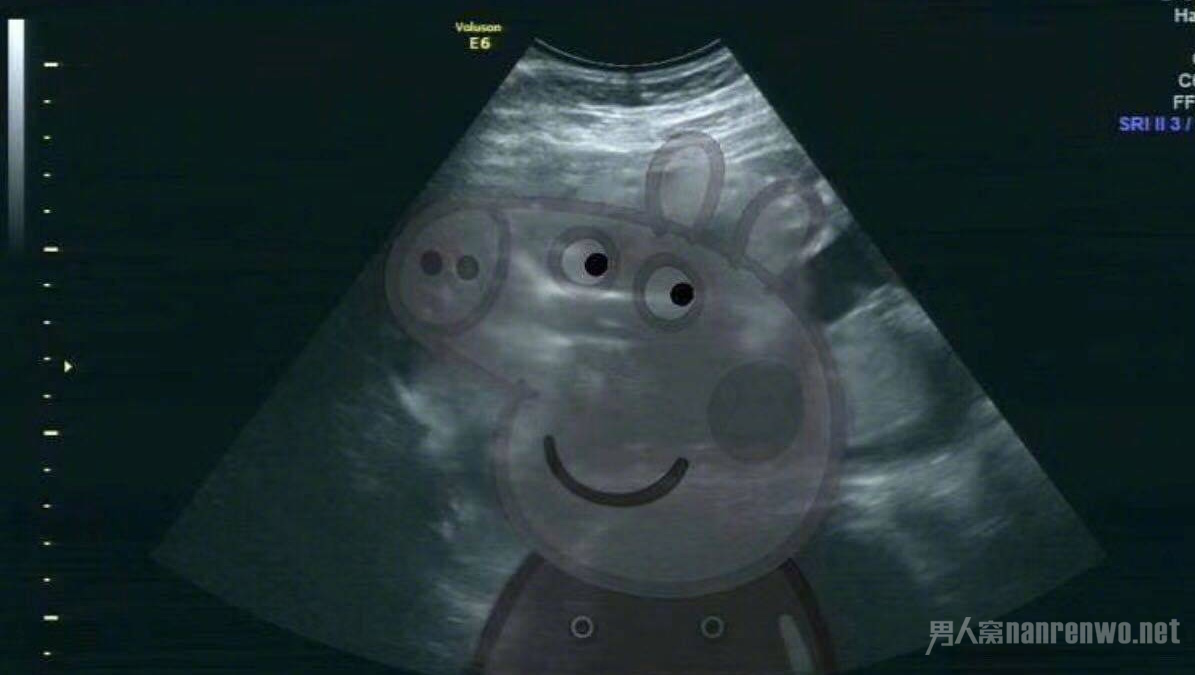 ɹBƬ