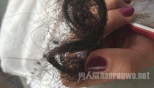 鹿女士被扯下的一撮头发