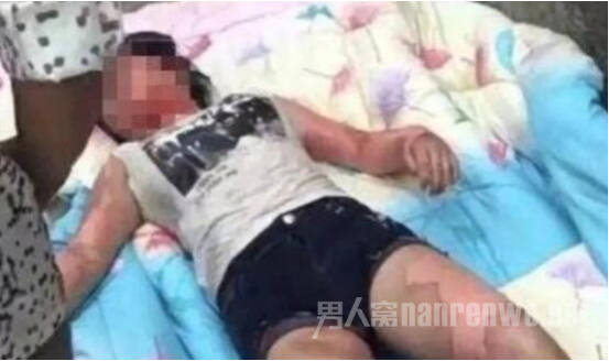 少女全身多处受伤