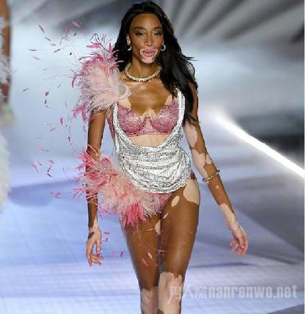 维密超模Winnie Harlow