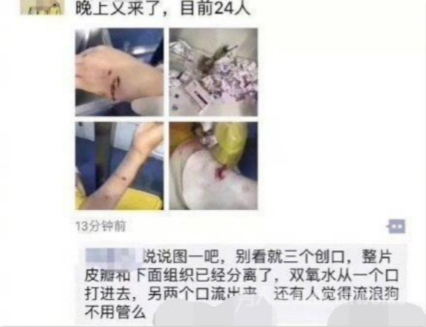流浪犬咬人