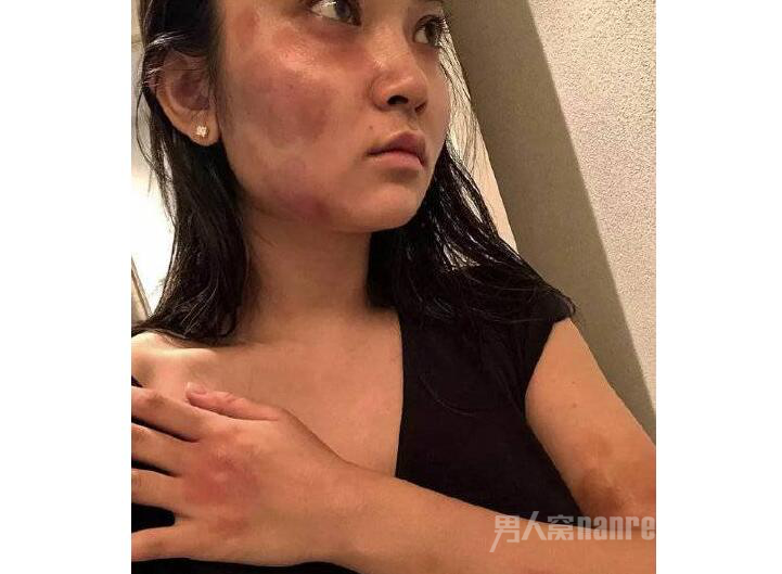 蒋劲夫女友被家暴