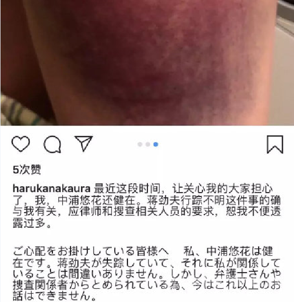 中浦悠花指控蒋劲夫家暴