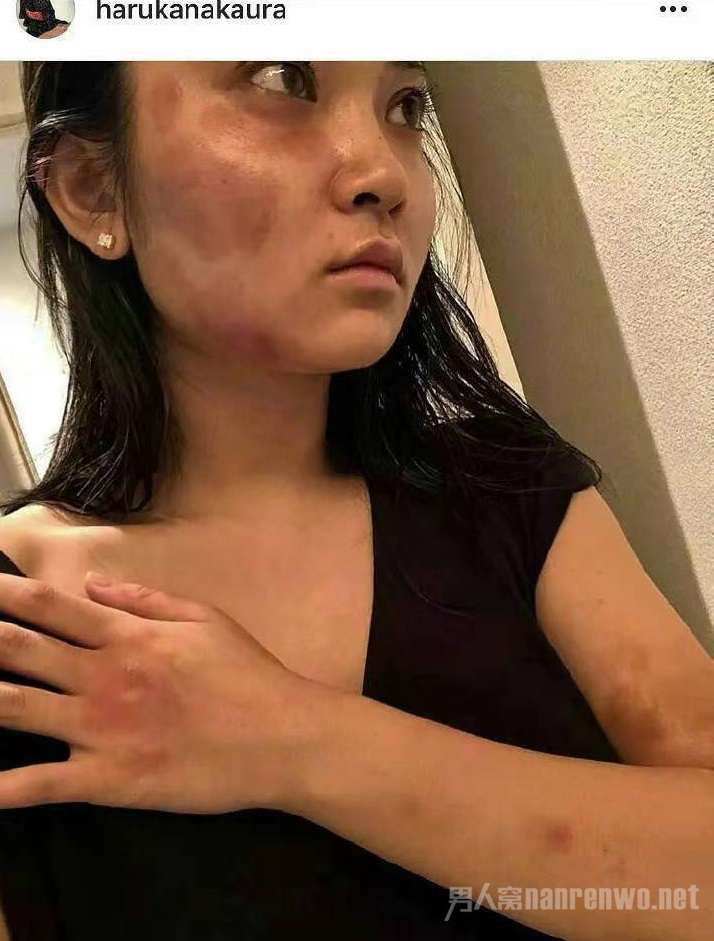 蒋劲夫家暴日本女友