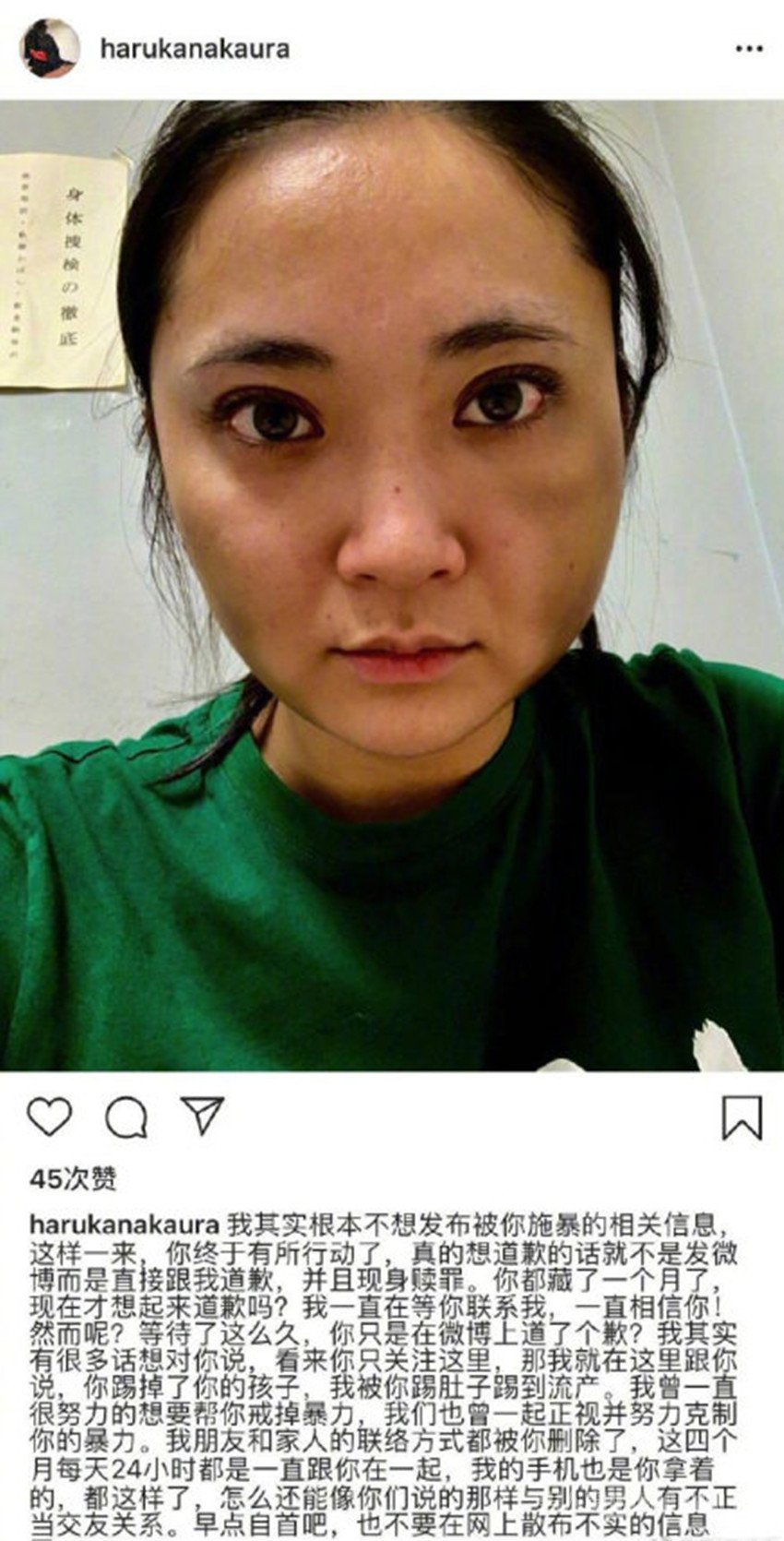 中浦悠花自曝被踢流产