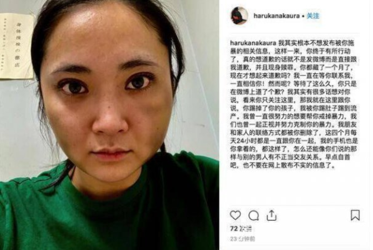 中浦悠花控诉被殴打致流产