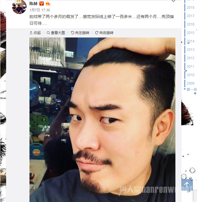 　　陈赫秃顶指日可待