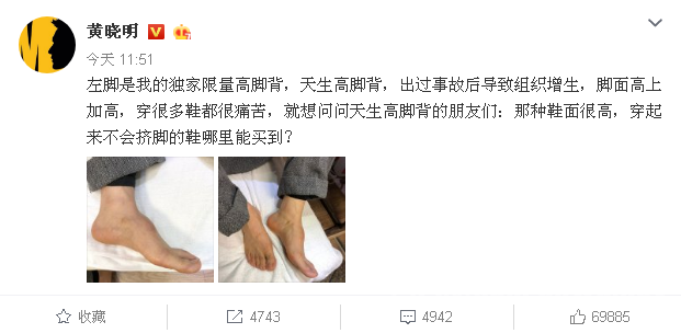 黄晓明回应垫鞋垫