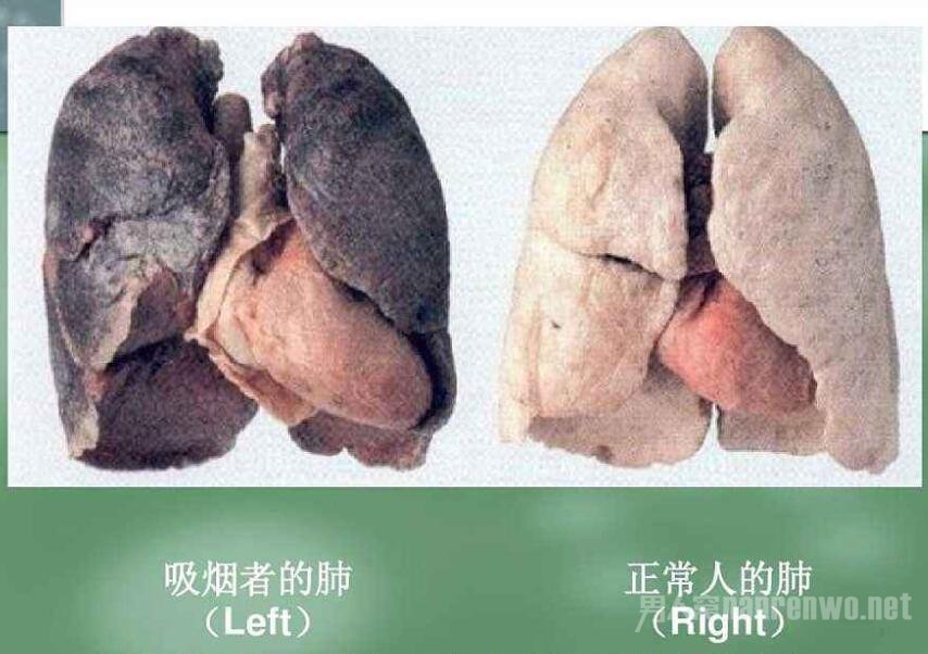 内脏病变